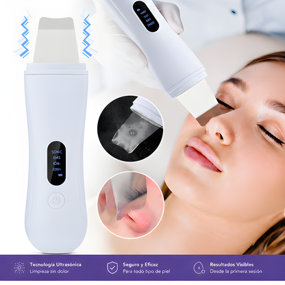 Sonäre Lumé — Espátula Ultrasónica Facial